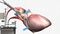 Koronare Bypass-Operation mit der Herz-Lungen-Maschine