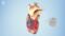 Implantation eines Herzschrittmachers